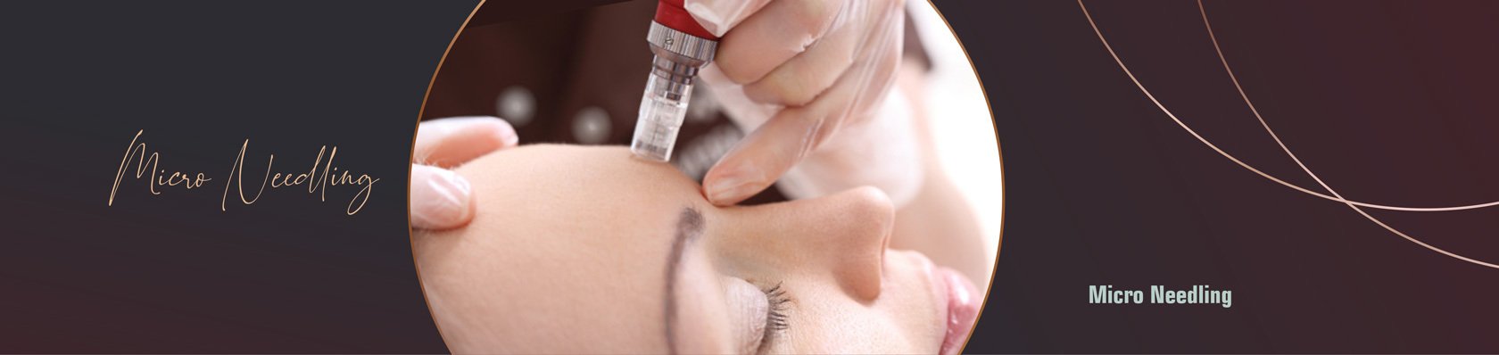 Microneedling im Studio Skin Glow by Nina Lo