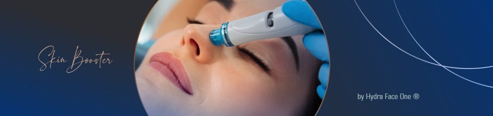 Radiofrequenz-Needling im Studio Skin Glow by Nina Lo
