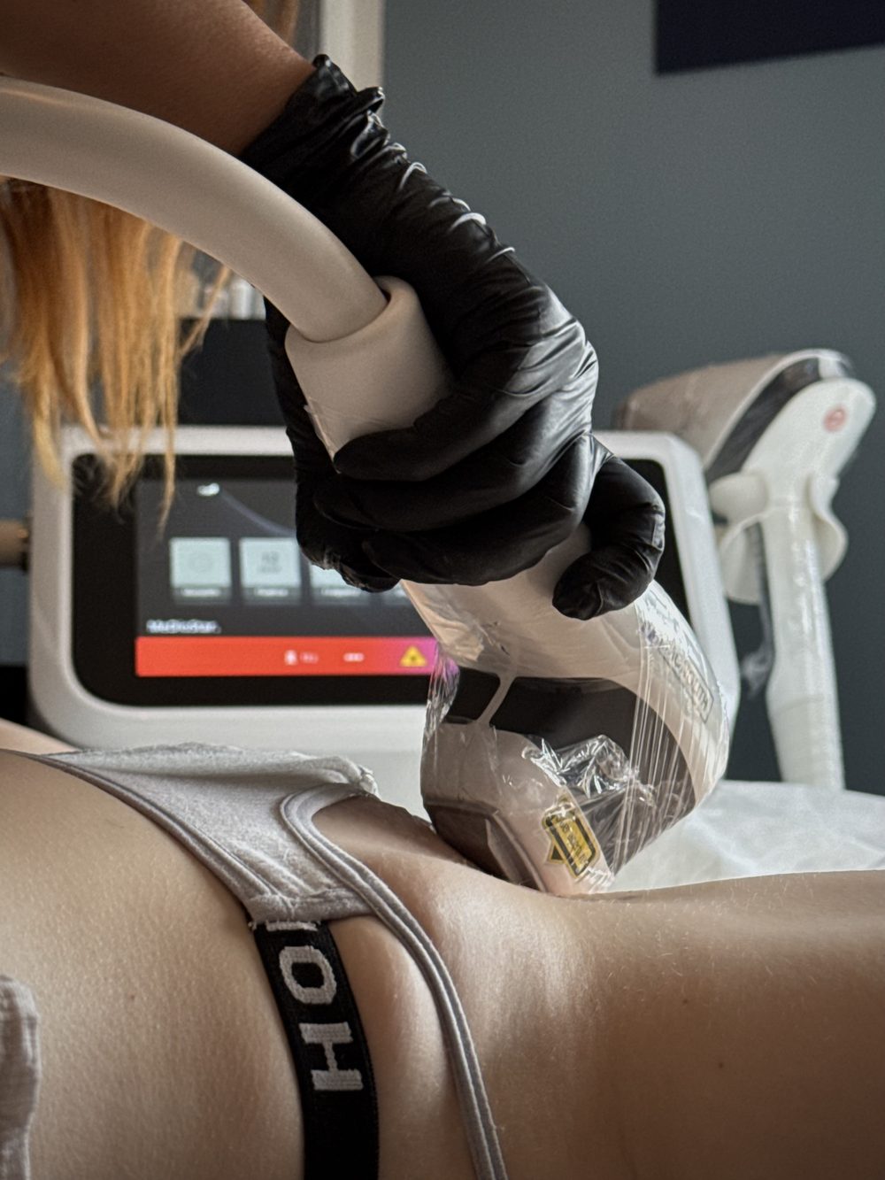 Laser-Haarentfernung Intimbereich im Studio Skin Glow by Nina Lo